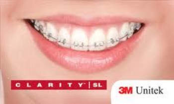 phau thuat chinh hinh rang mat va chinh nha thong thuong