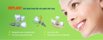 cay ghep implant rang