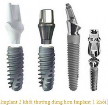 implant nha khoa la gi 