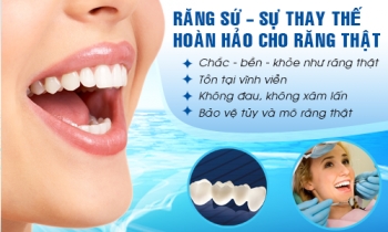 khac phuc chung e buot sau khi boc rang su