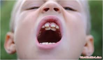 nhu ng ngo  nha n ve  ha m rang su a