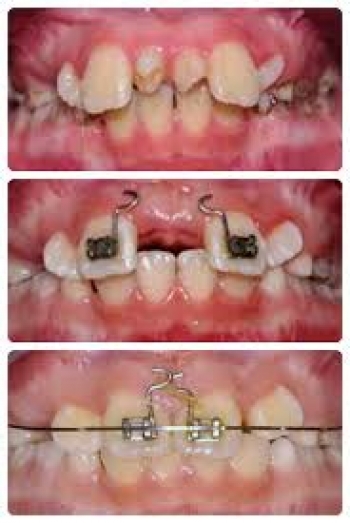 tai sao tre em nen di kham tong quat voi bac si chinh nha  